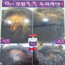큐사랑반지