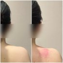 구리 다이어트 제이 더 에스테틱 에너지머슬핏 등관리 대만족 후기