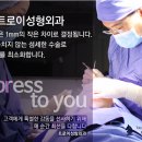 트로이성형외과의원 네이버블로그