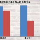 협심증에 좋은 음식 먹기 전에 살펴볼 것들 이미지