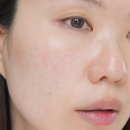블랙헤드 코피지 제거 올영추천템 메디힐 팩클렌저 솔직 후기