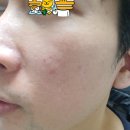 사월의봄한의원 이미지