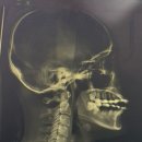 노랑통닭 논산점 | 나 더운 거 넘 싫어~...