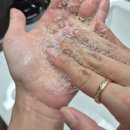 더블유(W)헤어 | 리스킨 HAMOCELL 더블유헤어로스샴푸 가려운두피 정수리머리숱