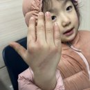 CU군포원광대병원점 | [어린이 화상 치료 후기-1] 캠핑장 난로에 심재성 2도 화상, 산본 원광대병원 응급실, 소아 화상치료