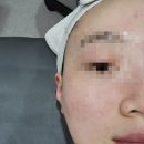 수연 | 대구동구마사지 대구피부관리 '수연테라피' 얼굴관리 받은 후기