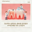 일상에서 살펴보는 올바른 관리법과 부작용 예방 치아 교정장치