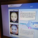 다이즐한의원 | 수원 피부과 추천 광교 동탄 인계동 피부과 고민 끝 다이즐한의원 라디쥬 스킨부스터 체험 후기