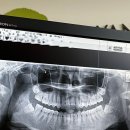 수성사랑니치과의원 이미지