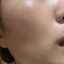씨유뉴일광동원1차점 | 센텀피부관리 모공 피지 들뜸 고민 한번에 해결하고온 후기