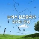 눈에서 검은물체가 보이는 현상 단순 노화일까 질환일까 이미지