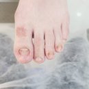 레푸스인천부평씨지브이(CGV)점 | 부평 발톱무좀 전문 케어샵에서 관리받은 후기 &#34;레푸스부평CGV점&#34;