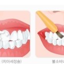 연세부부치과 네이버블로그