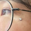 더멀 피어싱, 피어싱, 눈 밑 피어싱 후기