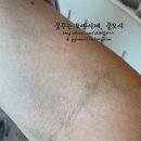 순천향대학교부속부천병원 네이버블로그