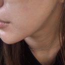 바른정성형외과의원 | 신사역리프팅 브이턱커스텀 리프팅 뷰티바성형외과 다녀온 솔직후기 / 내돈내산