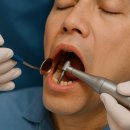&#34;임플란트,브랜드 마다 가격이 천차 만별인데,,,어떤게 좋은걸까?&#34;-하남 임플란트 치과 추천