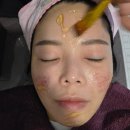 해율한의원 | 홍대 여드름흉터 치료 후기, 해율한의원 솔직 리뷰