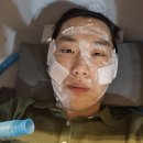 건강한뇌신경과의원 | 서울 명동피부과 여드름흉터 치료 srs 패키지 레이저 2달 후기 내돈내산