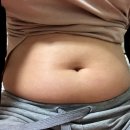 365리셋의원 이미지