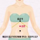 시솔 이미지