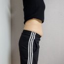 복부지방흡입 치골, 엉덩이 지방이식 한 달 후기 강남 복부지흡 엉덩이 지이