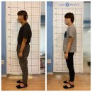 삼희개발(주) | [압구정필라테스/클럽필라테스] 필라테스로 체형교정, 굽은등, 거북목 교정 후기!