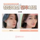 청담여신성형외과의원 이미지