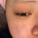 한성의원 | [아비쥬의원 인천구월점] 인생 첫 피부관리(피코토닝+비타민관리)