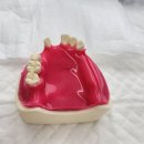 덴탈플란트 이미지