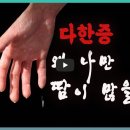 다한 | 다한증 치료 후기 모음｜보톡스·미라드라이·수술 실제 경험 비교