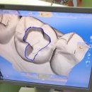 에이블치과기공소 이미지