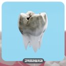 평택 고덕 충치 어린이 치과 야간진료 가능여부