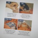 다우한의원 네이버블로그