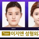 윤곽