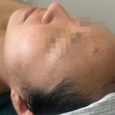 GS25율곡스퀘어점 | 천안 불당동 '티아뷰티랩 스킨&amp;네일' 문제성 피부관리 솔직후기