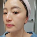 용담로117번길 | 인천 연수동 피부관리 전문 뷰에나에스테틱 슈퍼젝션 후기