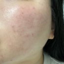 서울영문초등학교 | [서울] 문래동피부관리 추천, 사운드바디사운드스킨 영등포 Organic 센터 더블임팩트 후기