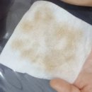 위드미 평택고덕삼성점 | [서정리역피부관리] 골드테리피는 "스킨위드그레이스"