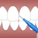 보가치과의원 이미지