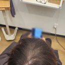 헤어원 - 은평구 서오릉로 216 | 구미미용실 <헤어원> 1대1 맞춤 두피관리 경험 후기