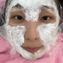 슈바피부관리 | [편평사마귀 제거] 얼굴 요철 제거 완료✌연말 자기관리(듀오덤 없이)