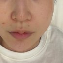 부산 서면 피부관리 제니퍼에스테틱 세멘시트 후기