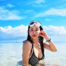 베스트웰피부과의원 | 신사역 피부과 신사세레아의원 티타늄 30KJ 여름휴가 후 내돈내산 관리 후기
