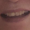 연세내일치과의원 이미지