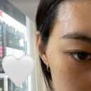 김도연피부 이미지