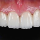 뉴티스치과기공소 이미지