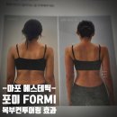 헬스포미 | 마포 에스테틱 포미에서 복부 바디컨투어링 받은 후기, 윗몸일으키기 5만번 한 효과