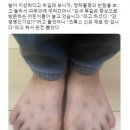 요즘 유행하는 피부병 이미지