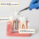 오래오래 튼튼하게 틀니&임플란트의 모든 것 이미지